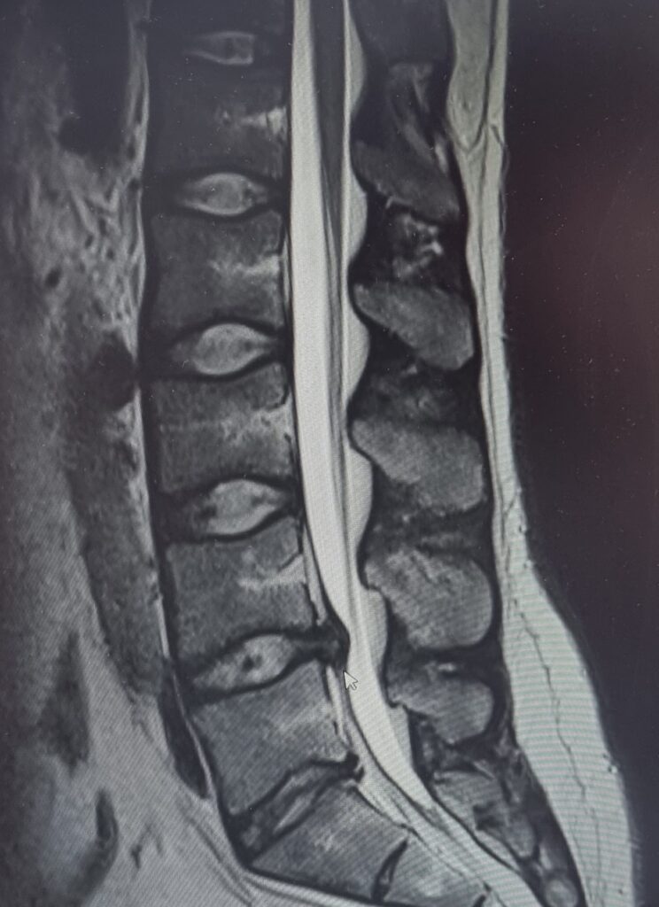 výhřez ploténky SM systém Brandýs nad Labem